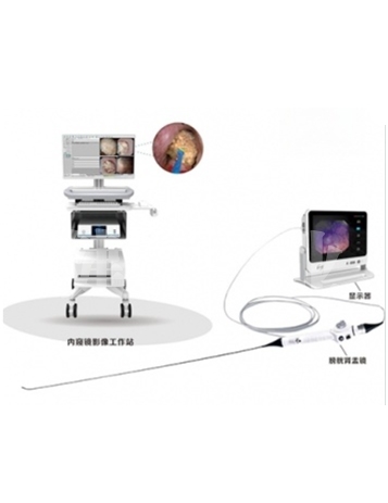 软性膀胱肾盂电子内窥镜